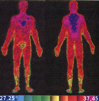 Imagem infravermelha do corpo humano antes e depois de uma corrida ao ar livre (30°C e umidade de 75%) - Adaptado de Complete Soccer Training.