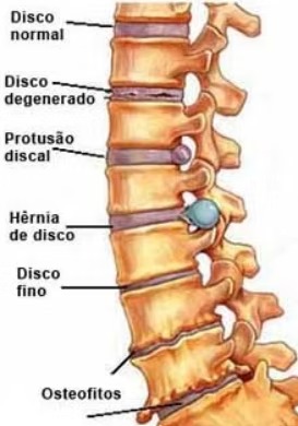 Exemplos de problemas de discos. Fonte: divulgação