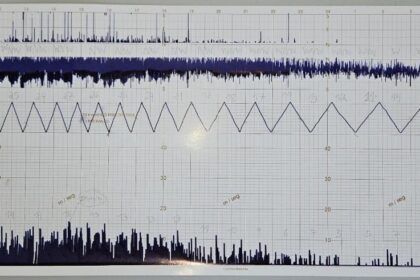Anemograma de 10/12/2025. Fonte: Estação Meteorológica Prof Paulo Marques dos Santos EM14-IAG-USP (CCBY)