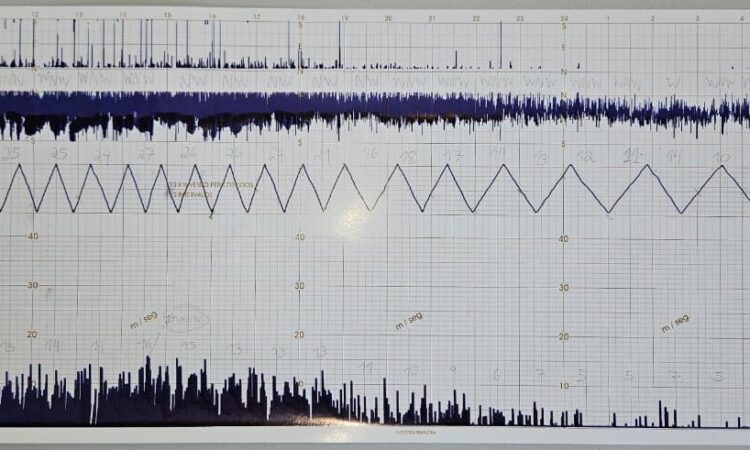 Anemograma de 10/12/2025. Fonte: Estação Meteorológica Prof Paulo Marques dos Santos EM14-IAG-USP (CCBY)