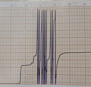 Pluviograma da chuva de 08/03/2026 da estação do IAG-USP, com maior intensidade entre 15h e 16h. Fonte: Estação Meteorológica Prof Paulo Marques dos Santos EM14-IAG-USP (CCBY)